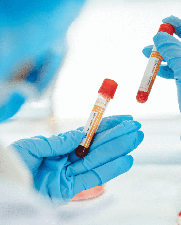 Lab tech holding 2 blood vials