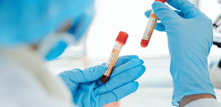 Lab tech holding 2 blood vials
